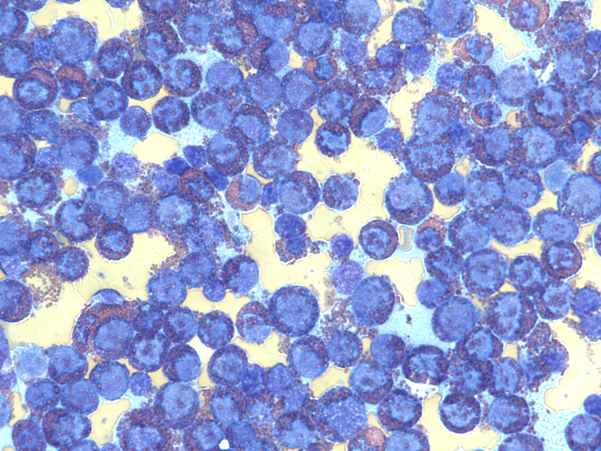 Bone marrow aspirate, high power